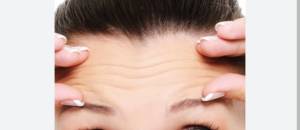 Се апаси во Битола за нелегален ботокс и филери