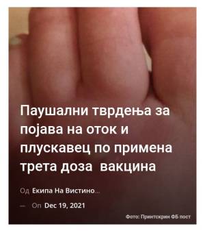 Паушални тврдења за појава на оток и плускавец по примена трета доза вакцина